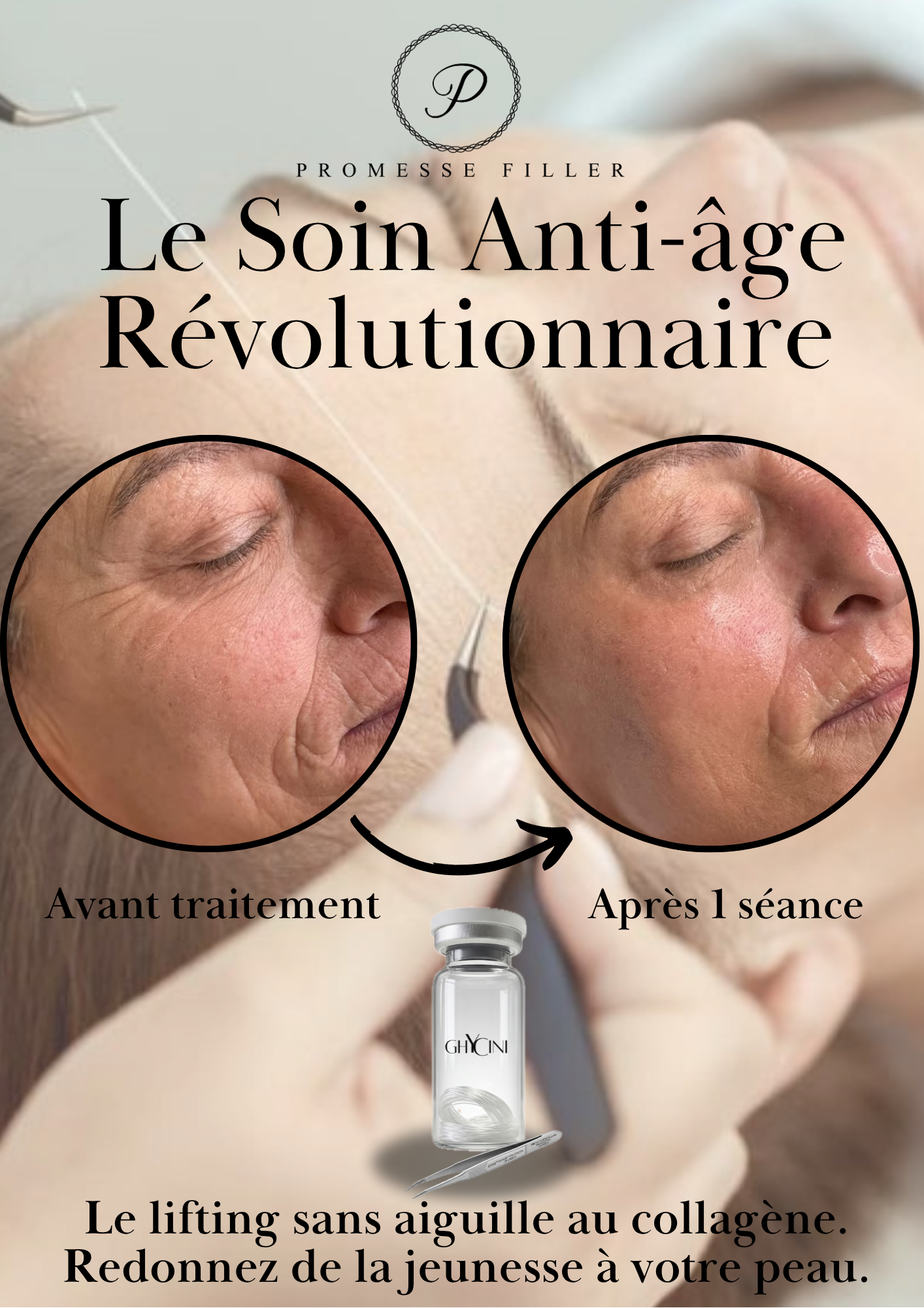 FORMATION LIFTING VISAGE FILS ET BANDES DE COLLAGENE PROMESSE FILLER